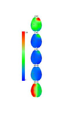 Полная максимальная амплитуда спектра мкВ/с, преобладание в левом полушарии.