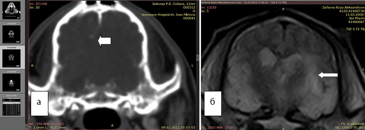 На всех рисунках представлены справа результаты МРТ - изображения, а слева - КТ в аналогичных срезах