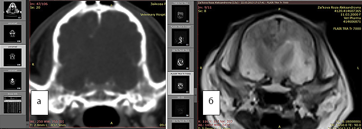 На всех рисунках представлены справа результаты МРТ - изображения, а слева - КТ в аналогичных срезах
