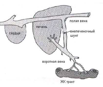 Схемы патологического портального кровотока