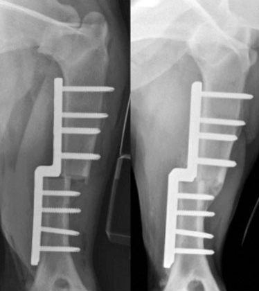 Рентгеновские снимки 7-летнего лабрадор-ретривера с синдромом сдавливания в медиальном отделе, перенесшего скользящую остеотомию плечевой кости
