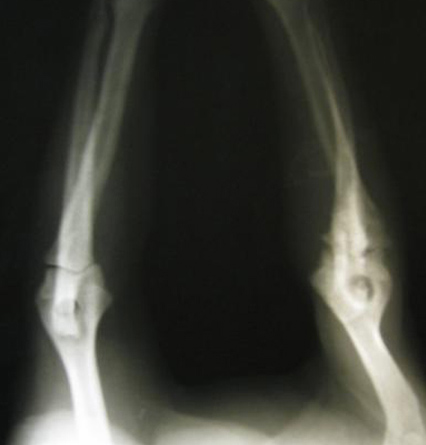 Мопс в возрасте 1г 2месяца; анкилоз и атрофия конечности в результате гнойного артрита