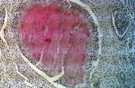 На фото гистопрепарат - гетерофильная гранулема в почке бананоеда при хрониосепсисе