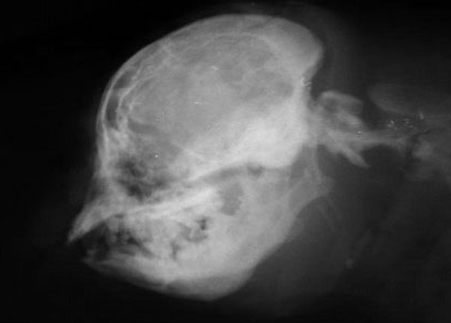 На рентгене видно, что недокус является причиной короткой нижней челюсти