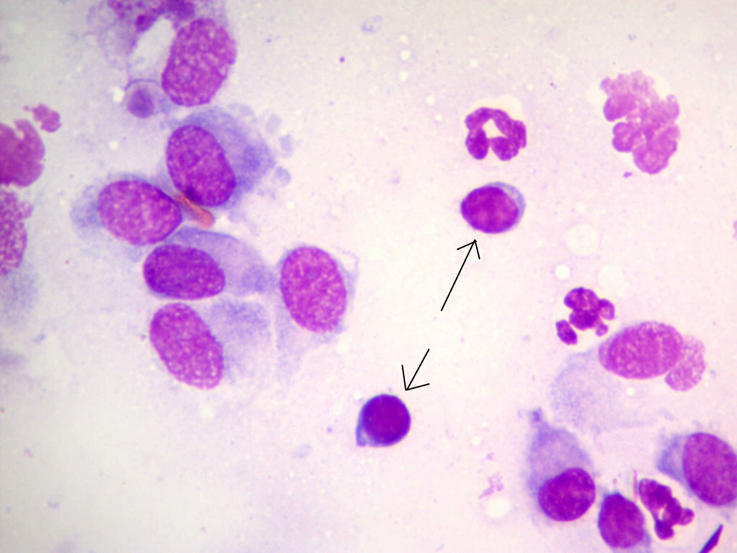 Рисунок 3. Лимфоциты в мазке с роговицы у собаки с паннусом