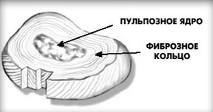 Межпозвонковый диск собаки 2. пульпозное ядро