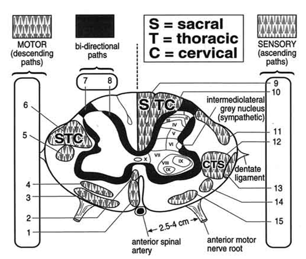 Схема: поперечный срез спинного мозга, в котором скомбинированы все основные структуры, в норме находящиеся на разных уровнях.