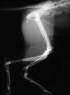 полный перелом - целостность кости полностью нарушена; часто со смещением отломков
