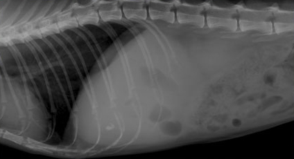 Рентгенография при кальцификации стенки желчного пузыря или формирования рентгеноконтрастных камней 