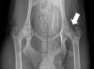  Рентгенограмма тазобедренного сустава собаки с болезнью Пертеса