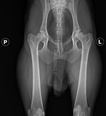 Рентгенограмма тазобедренных суставов. Это необходимый минимум обследования, который позволяет с высокой точностью подтвердить или исключить наличие болезни Пертеса даже в первой стадии