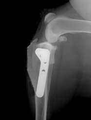 Рентгеновский снимок после операции TPLO