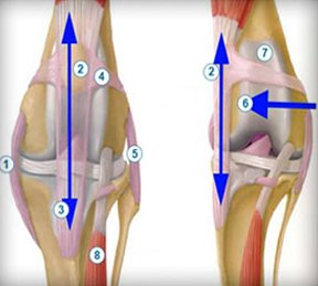 нормальное состояние коленного сустава и вывих коленной чашечки