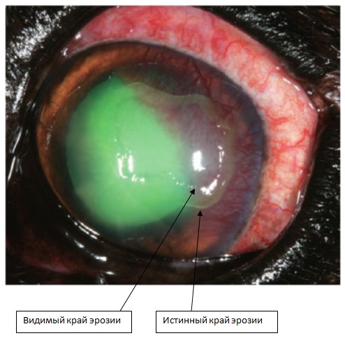 Эрозия роговицы глаза